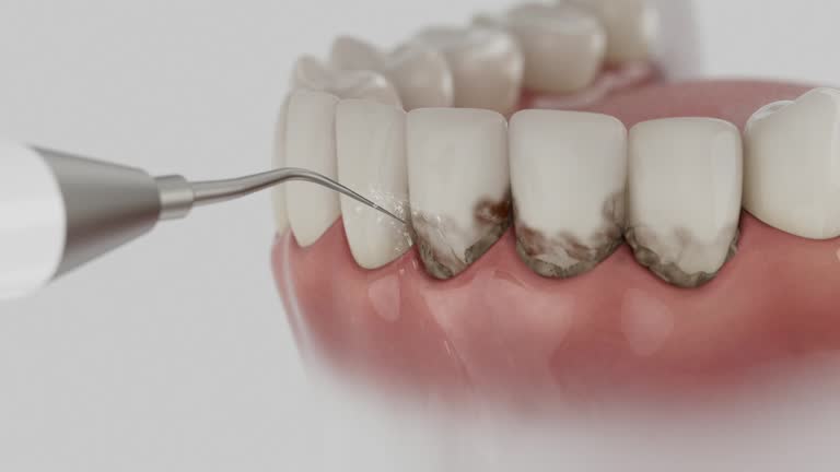 Reliable Dental Implants contractor in Beaver, OK by Smile Center Dentistry